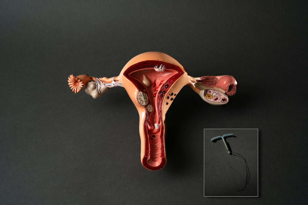 A medical prop showing female pelvic organs